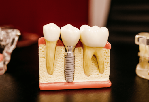 The 5 Best Dental Implant Centers in Houston Homepage